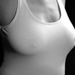 Do Česka přišly miniinvazivní prsní implantáty